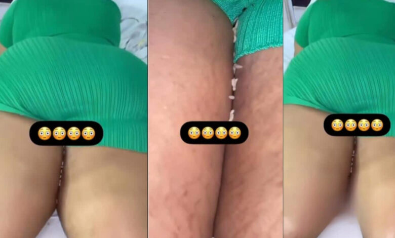 Butt Enlargement Surgery Gone Wrong