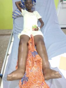 Parents need $16,000 to save 14-year-old daughter suffering from damaged heart valves