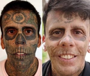 Brazil’s most tattooed man removed 2